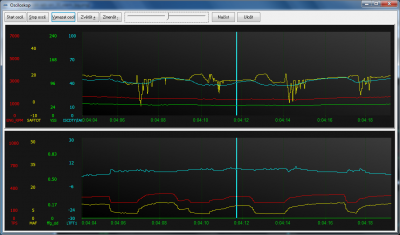 spark-adv-err_34_warm_lpg.png (101.88 KiB) Zobrazeno 1545 x Spark advance error when engine warm (LPG)
